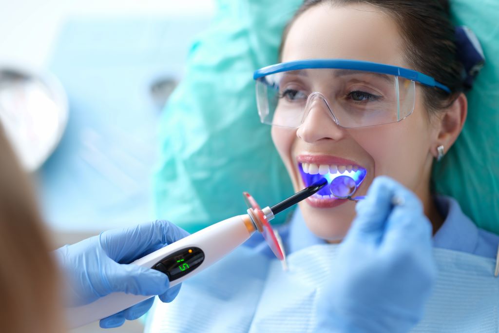 dental bonding in strathcona