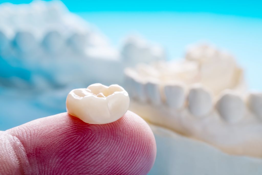 dental crowns and bridges near me