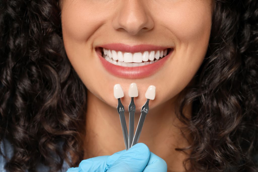 porcelain veneers in strathcona edmonton