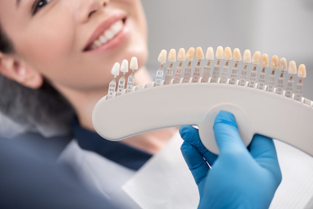 teeth whitening in strathcona edmonton